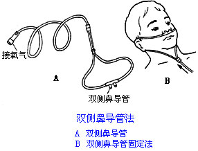 ◆肺病患者如何家庭氧療？